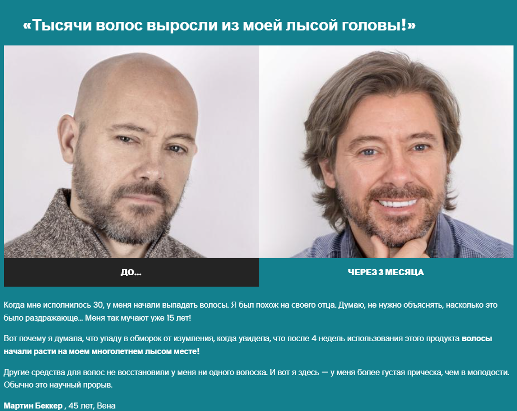 отзывы на средство от облысения